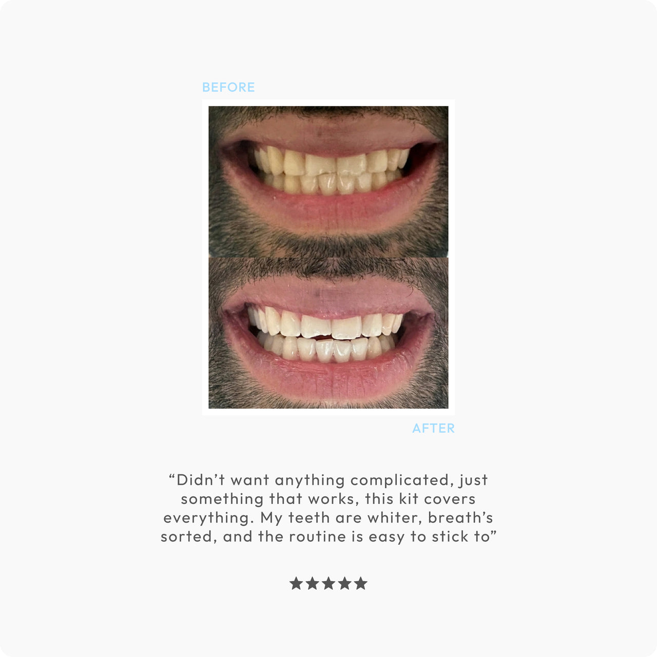 Icy Bear Dental Men's Whitening Ritual Kit — visibly whiter teeth in 14 days