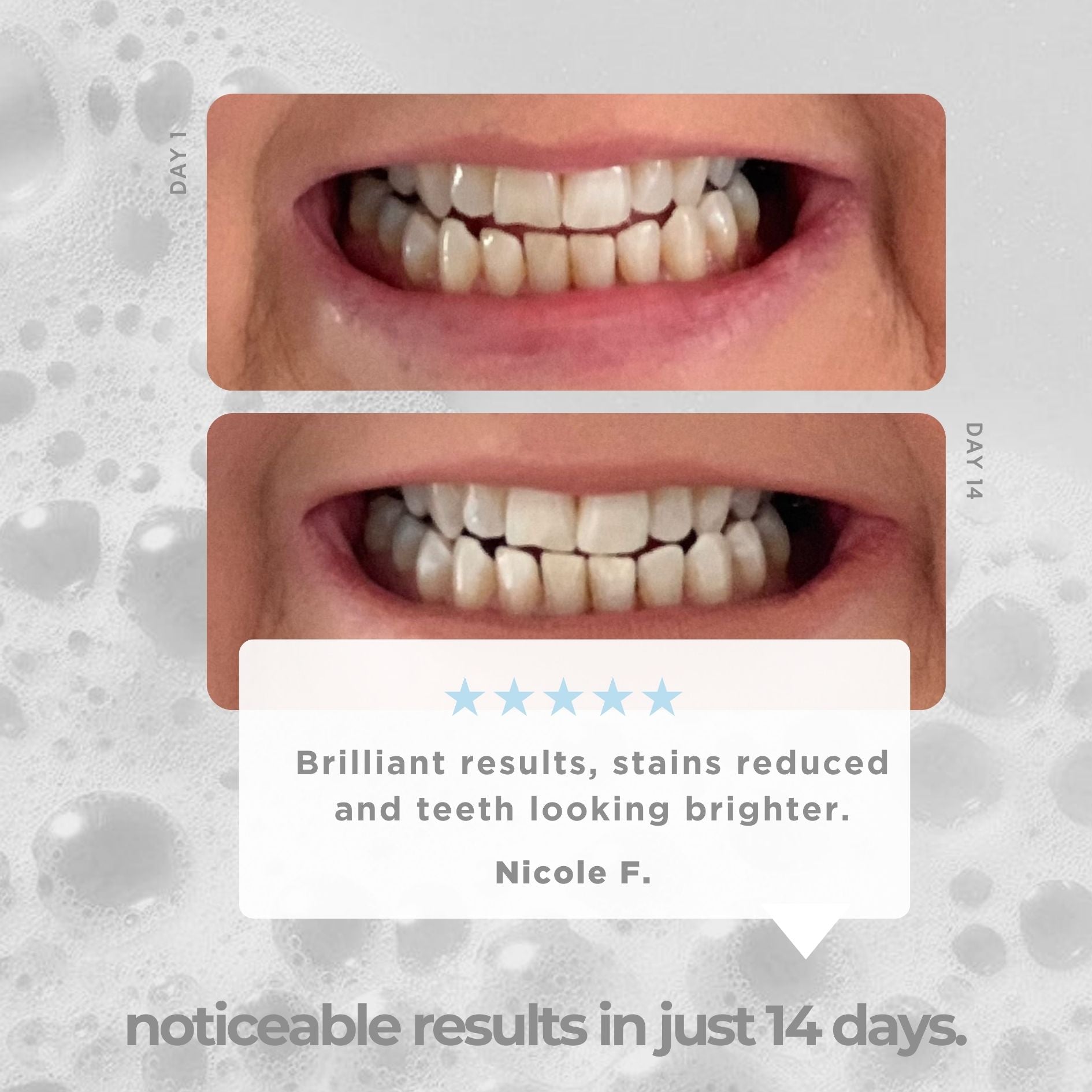 Teeth Whitening Strips - 3X 28 Pack – Icy Bear Dental