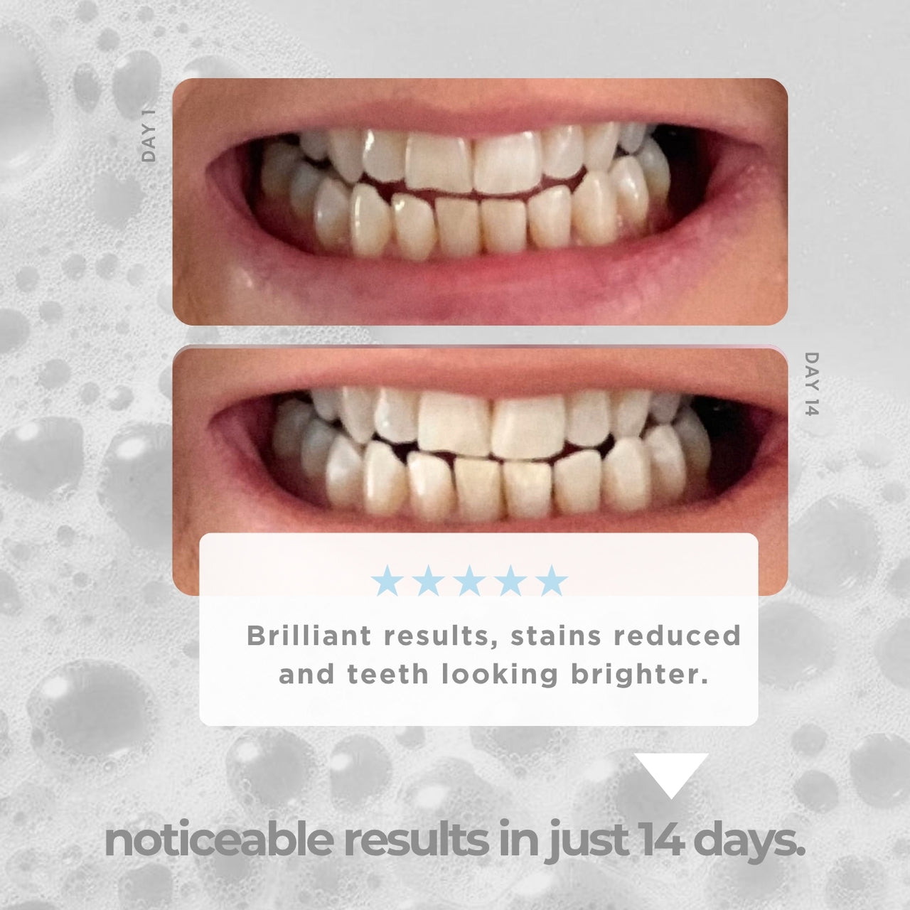 Teeth Whitening Strips for Men