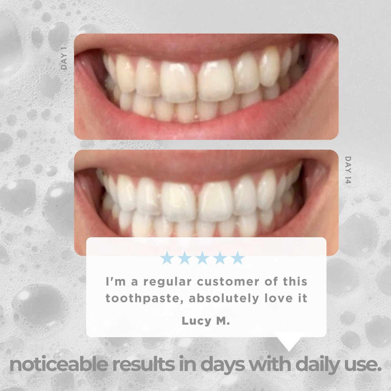 Teeth Whitening Toothpaste